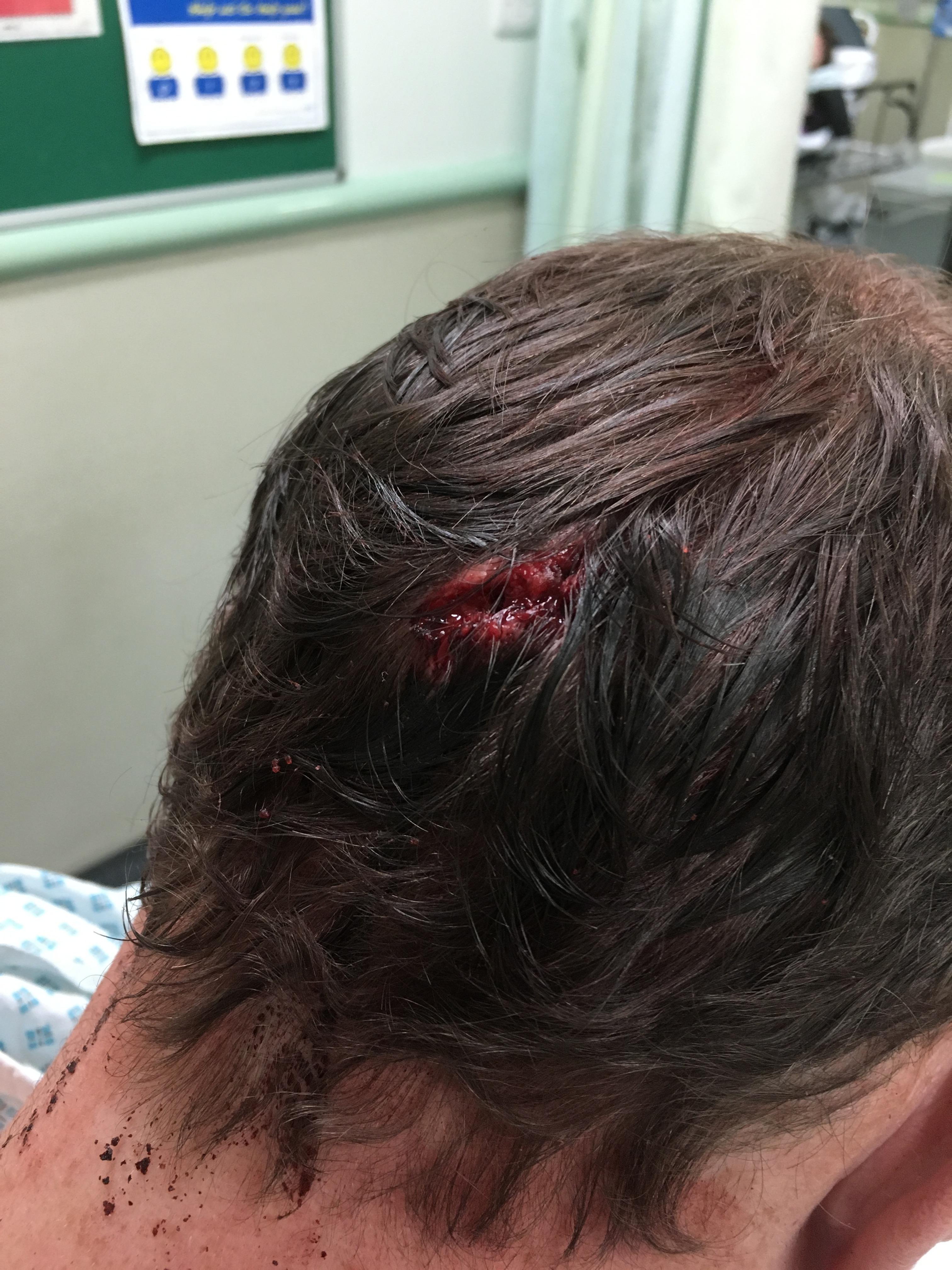Во время несвязанного инцидента, произошедшего в марте прошлого года, Фредди, которому тогда было 17 лет, был нанесен удар в живот и ногу в неспровоцированной атаке во время игры в футбол в Гизели